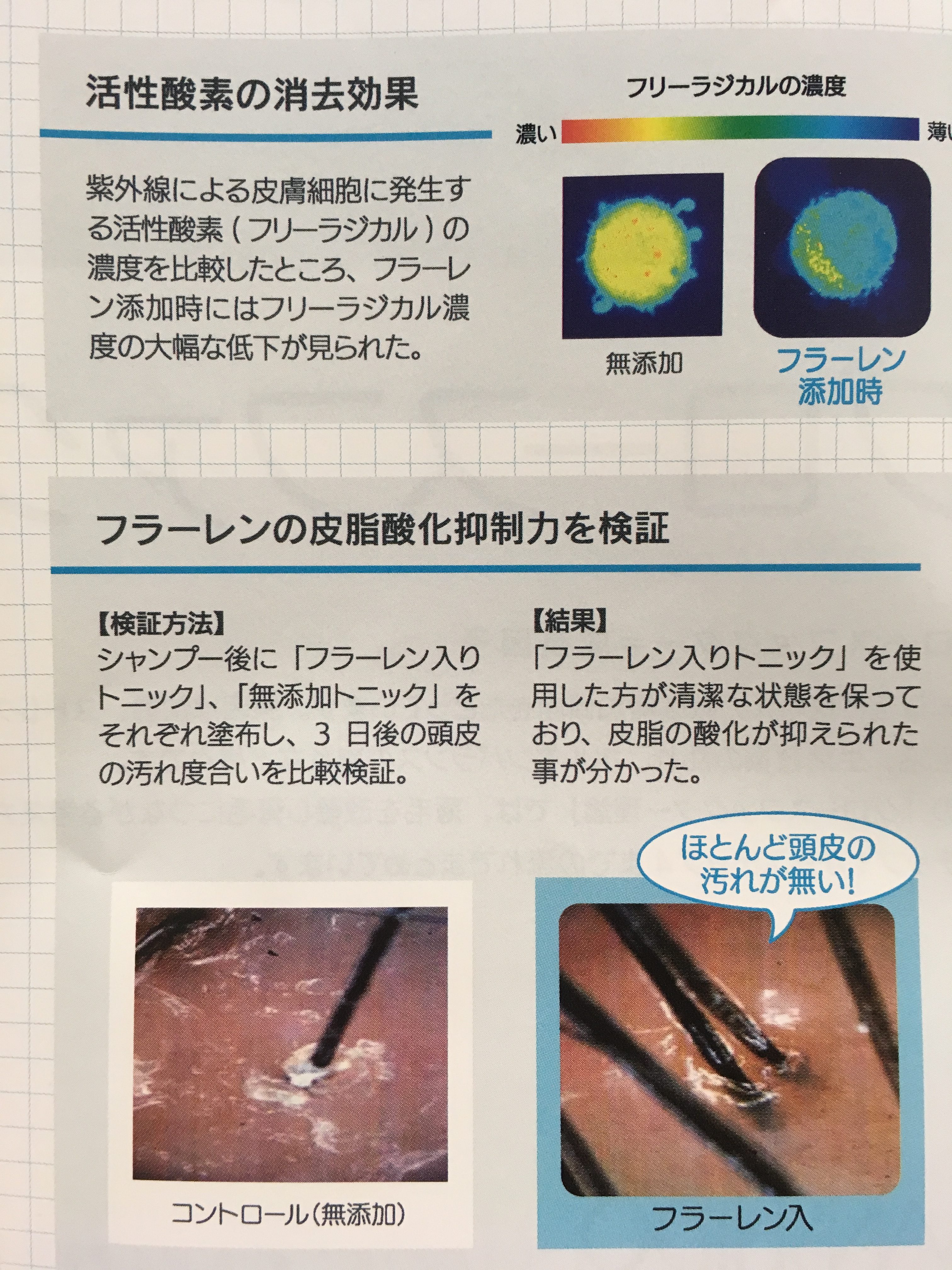 New 副作用なし の最新の育毛システムで薄毛解消 頭皮の脂 神戸三宮の美容室プライベートヘアサロンsur