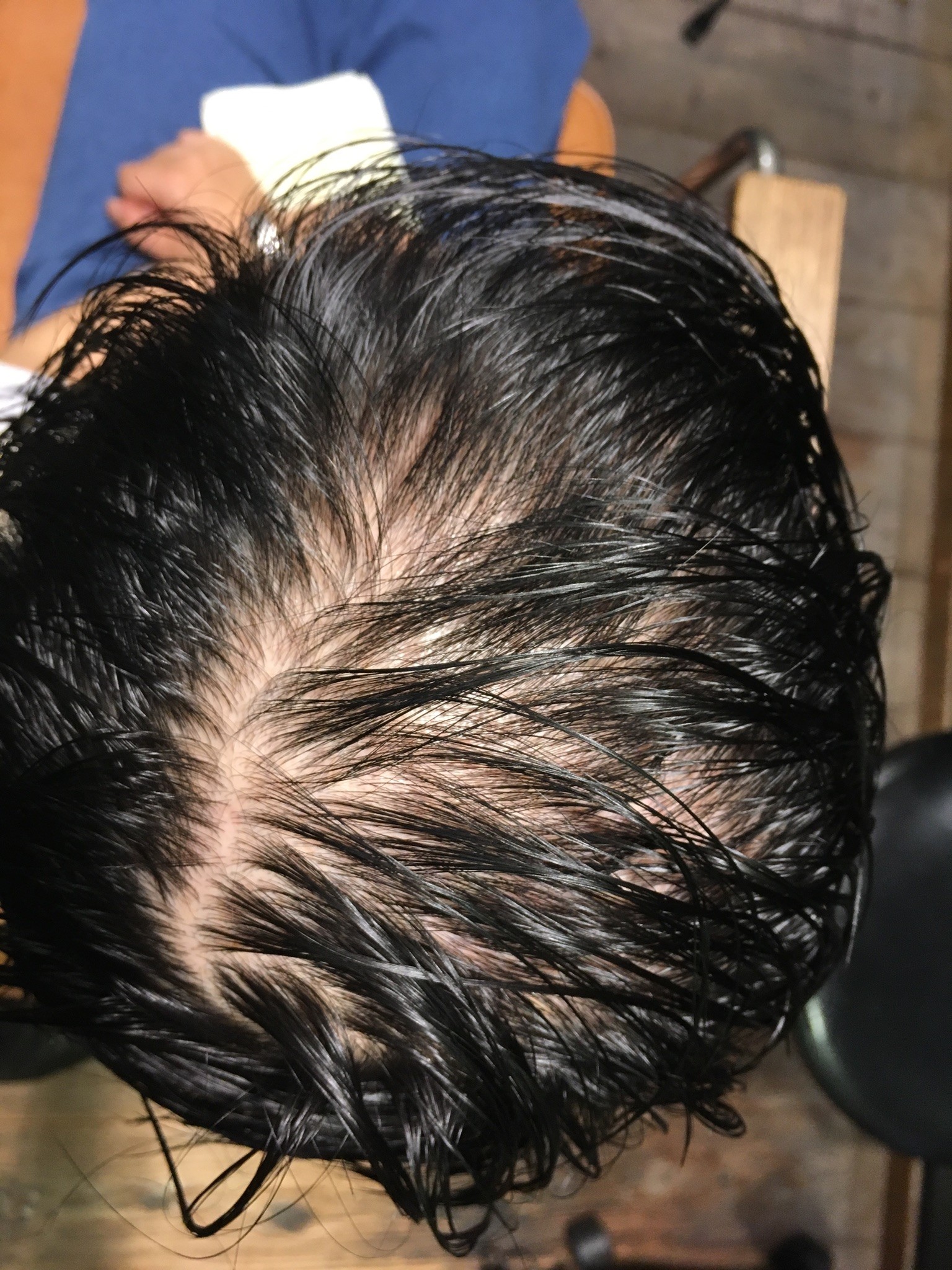 女性の薄毛！市販育毛剤、スカルプシャンプーで毛が生えない理由 | 神戸三宮の美容室プライベートヘアサロンSur